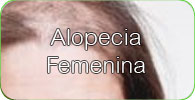 Alopecia femenina